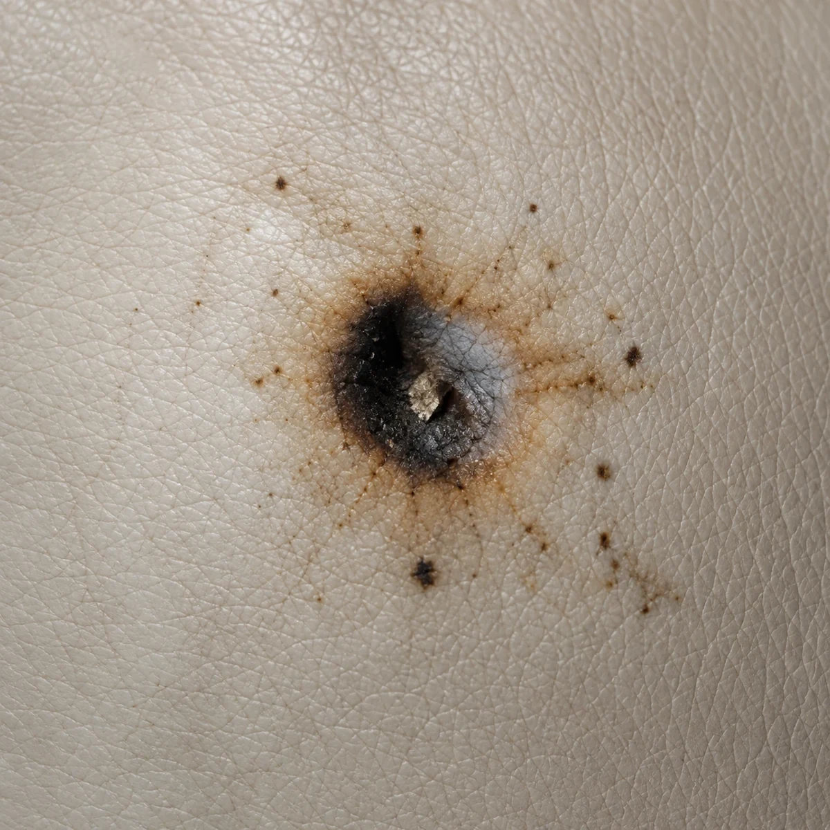 Cigarette burn mark on cream leather